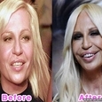 Celebrity Plastic Surgery Disasters